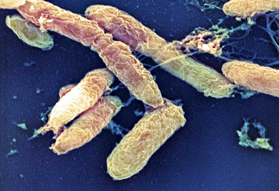 Epidemi - pest