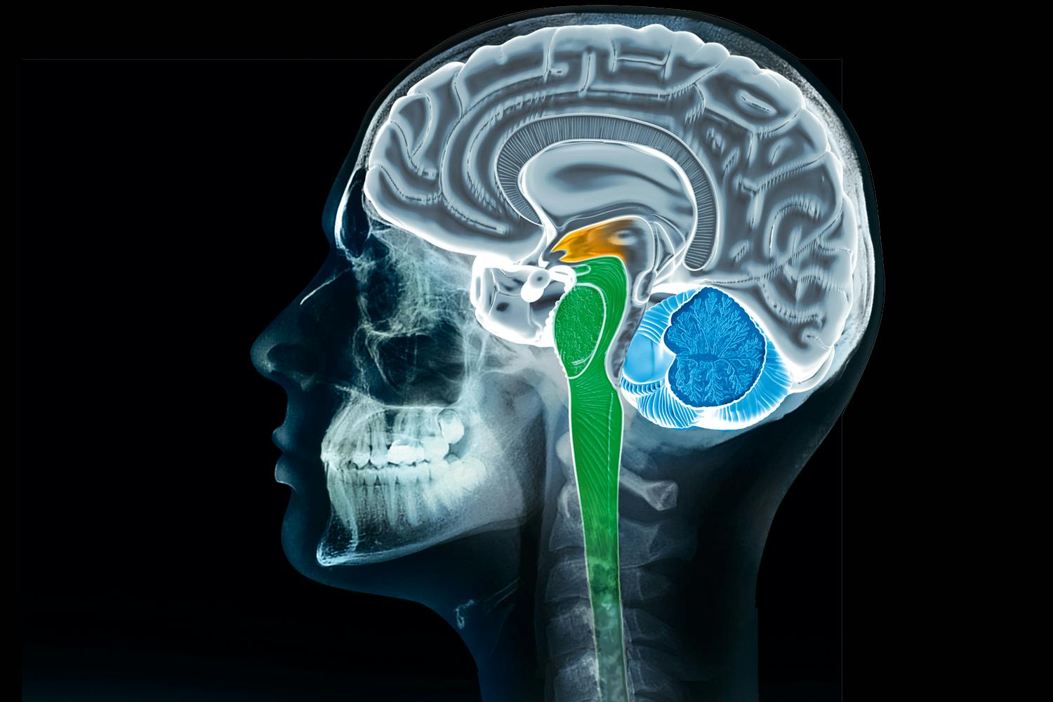 brain scan