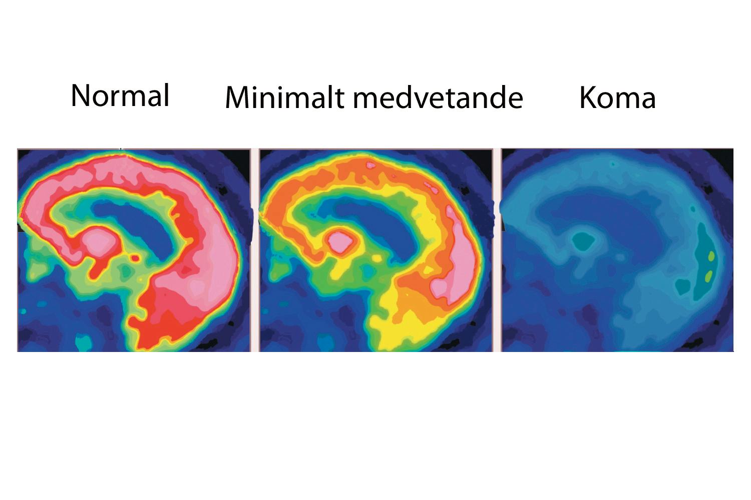 Brain scans