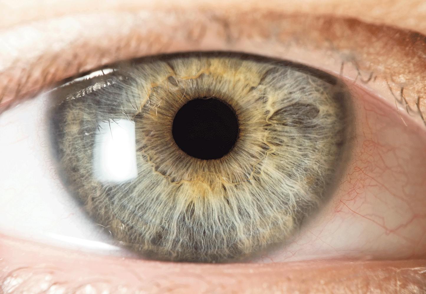 Iris