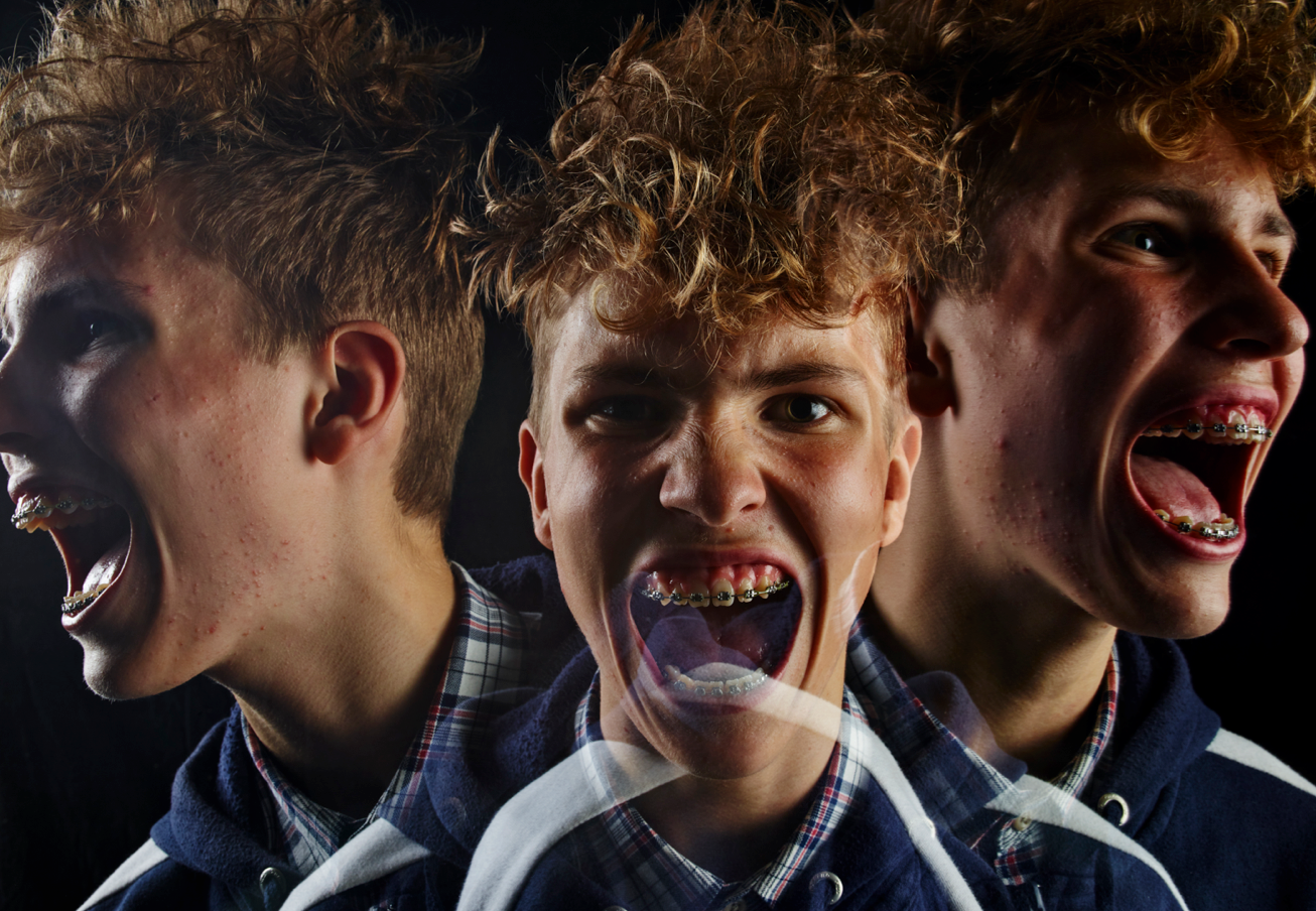 5 grunde til, at teenagere er umulige