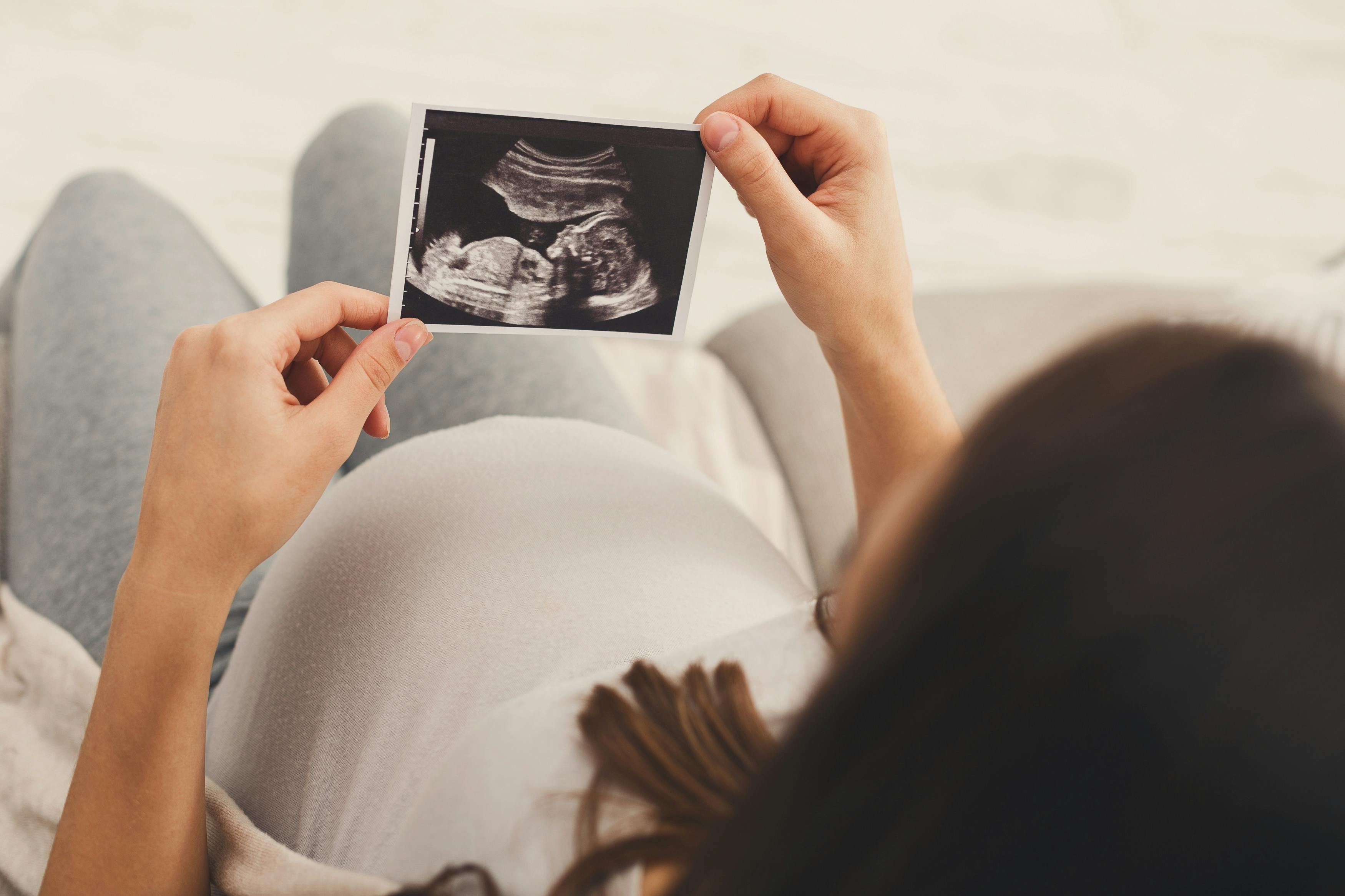 Husk at passe på dig selv, når du er gravid. Kvinde der er gravid