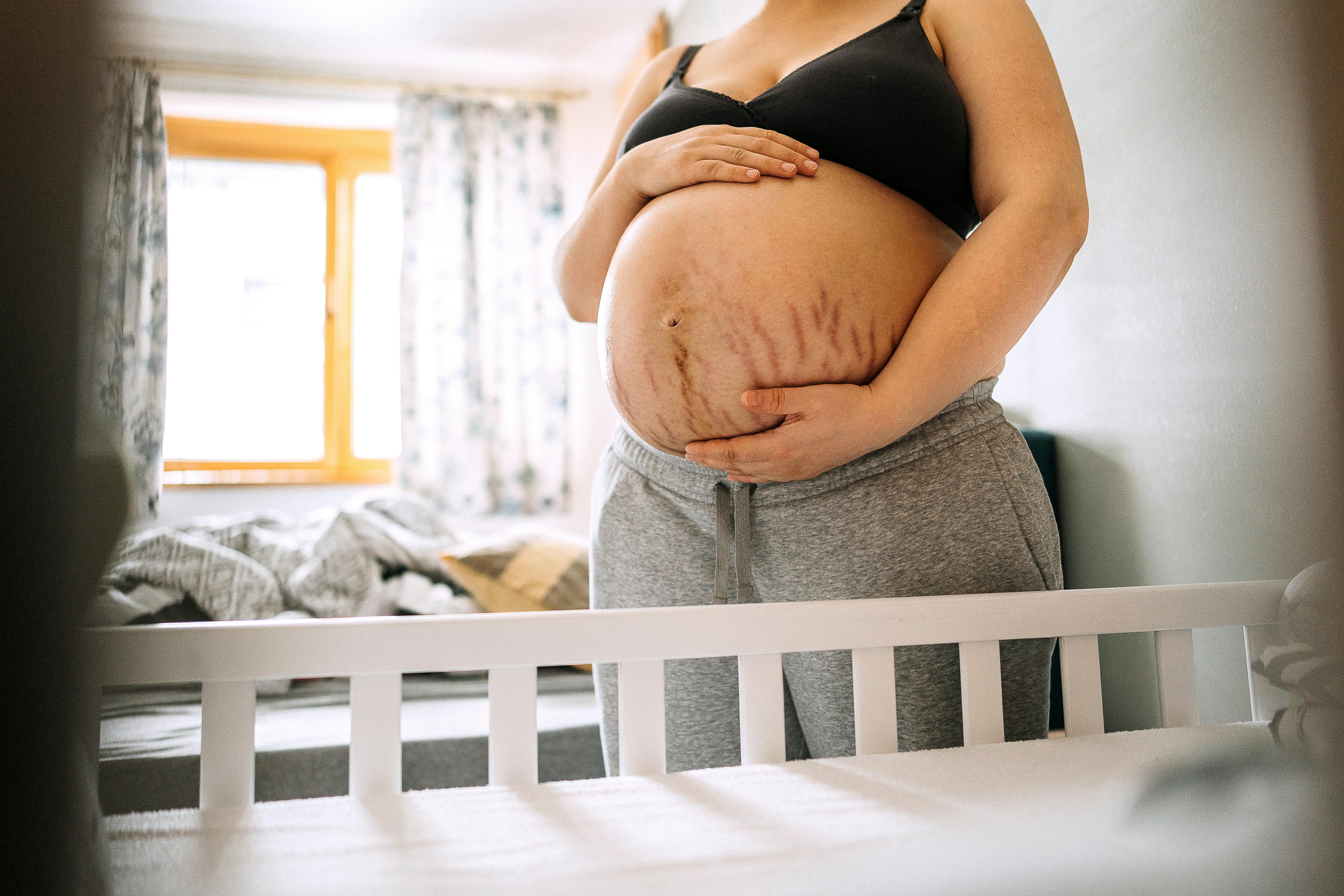 Mange kvinder oplever strækmærker i forbindelse med deres graviditet. Gravid med strækmærker