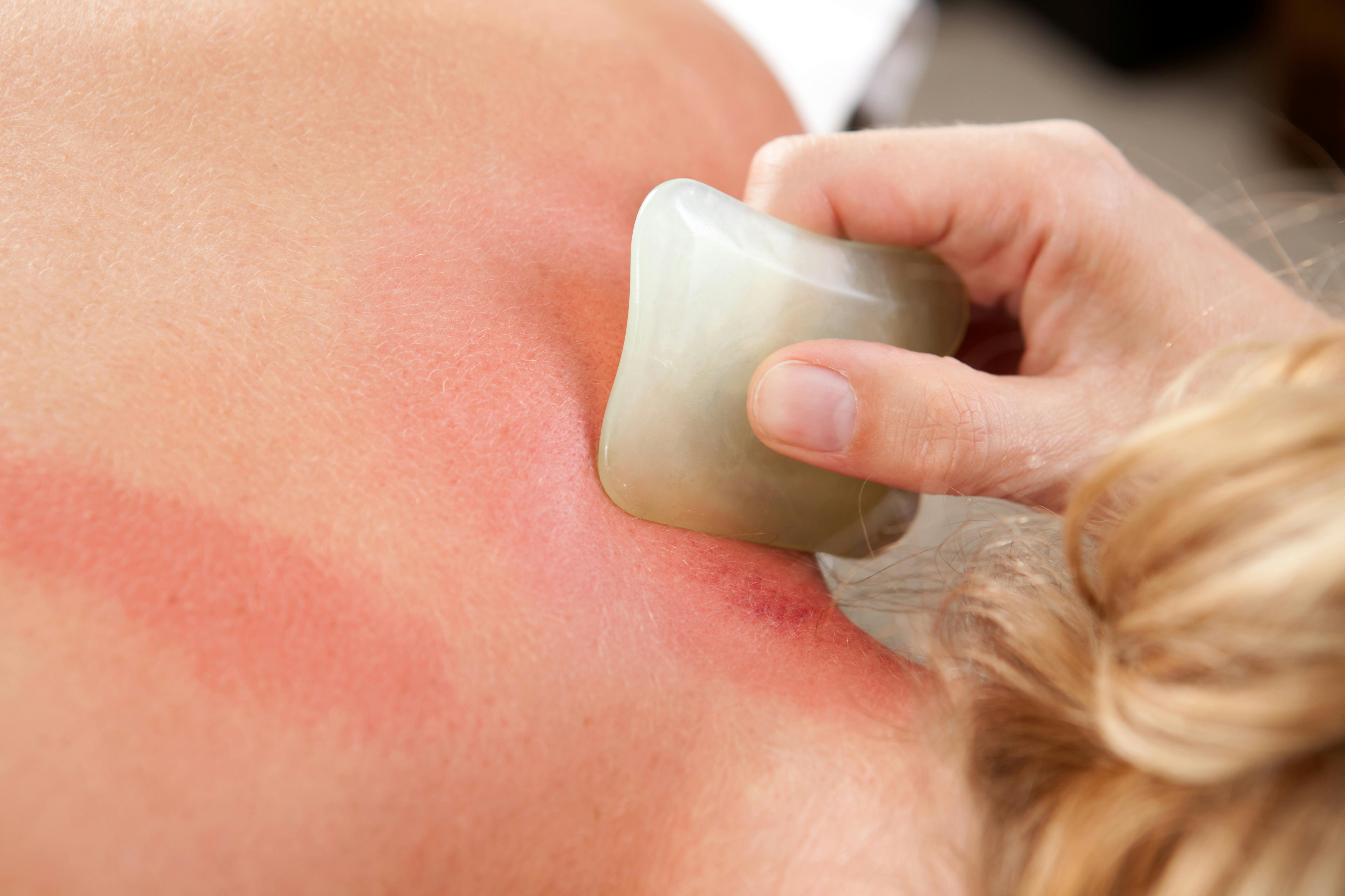 Gua sha-massage kan gives på både ansigt og krop. Gua sha massage