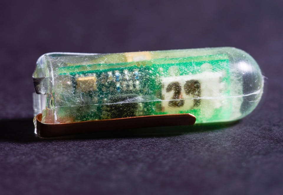 Surt batteri Batteri får energi från magsyra