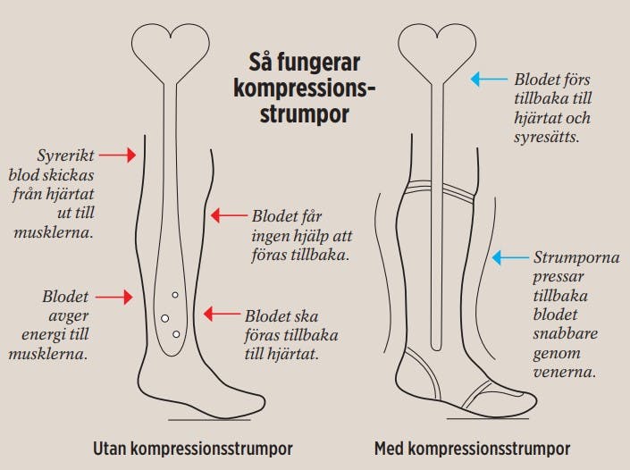 Testa strama strumpor Så fungerar kompressionsstrumpor