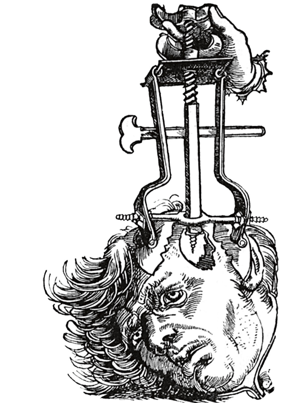 Bilderesultat for trepanering