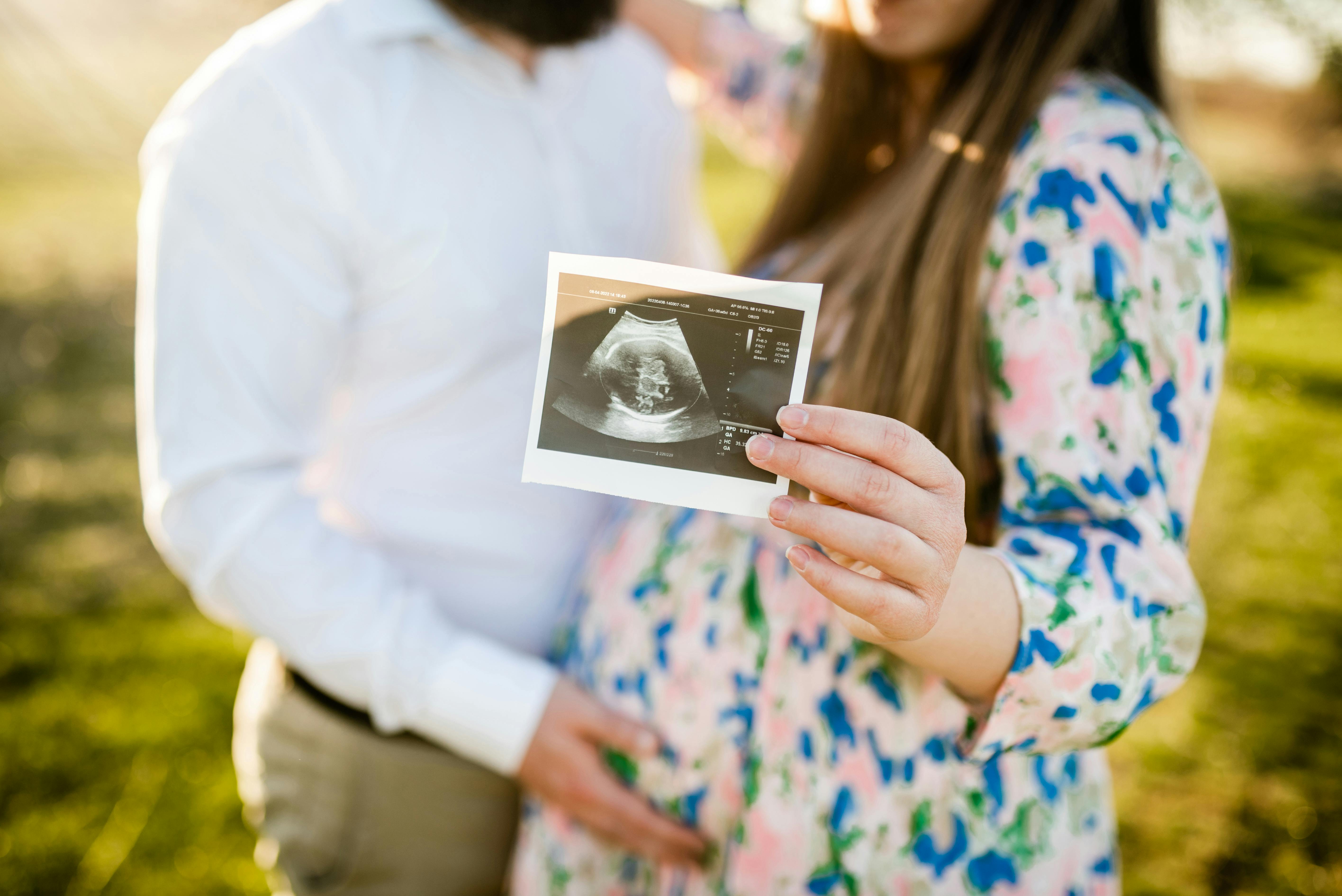 For mange gravide øges vægten for alvor, når uge 27 af graviditeten er passeret. Kvinde, som er gravid i uge 27, holder et billede fra skanning op, mens hendes mand holder om maven