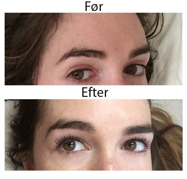 Lash lift test før og efter billeder